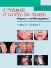 Imagen de archivo de Photo Guide of Common Skin Disorders: Diagnosis and Management a la venta por ThriftBooks-Dallas