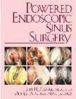 Imagen de archivo de Powered Endoscopic Sinus Surgery a la venta por Mispah books