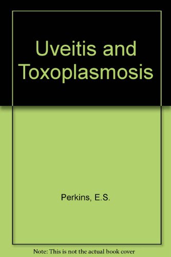 9780700012329: Uveitis and Toxoplasmosis