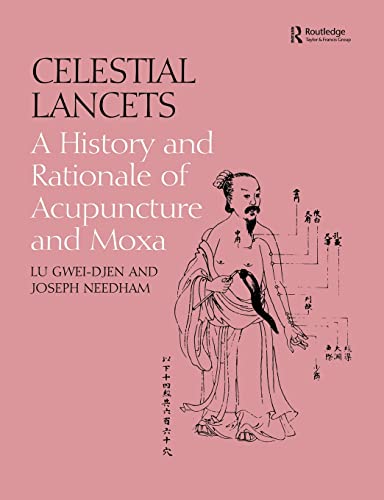 Beispielbild fr Celestial Lancets: A History and Rationale of Acupuncture and Moxa zum Verkauf von Blackwell's