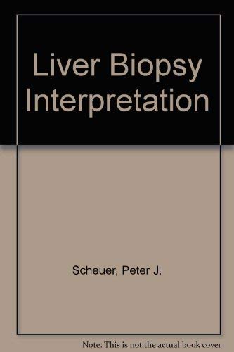 Stock image for Liver biopsy interpretation for sale by HPB-Red