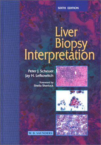 Imagen de archivo de Liver Biopsy Interpretation a la venta por HPB-Red