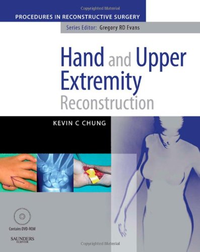 9780702029165: Hand and Upper Extremity Reconstruction (The Procedures in Reconstructive Surgery)