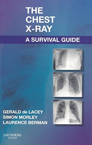 9780702030468: The Chest X-Ray Survival Guide