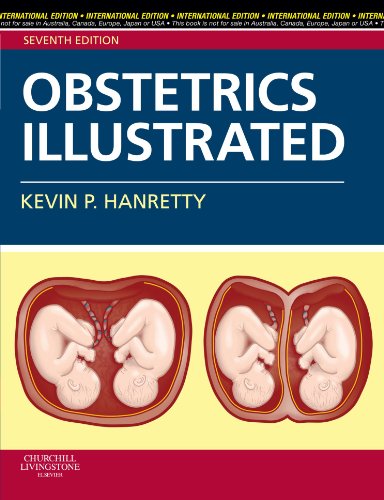 Obstetrics Illustrated International Edition, Seventh Edition (9780702030789) by Hanretty