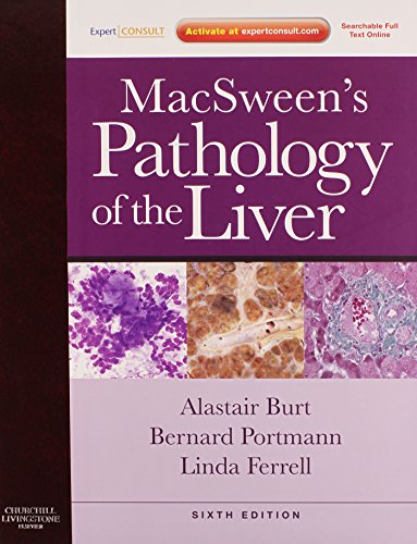 Stock image for MacSween's Pathology of the Liver: Expert Consult: Online and Print for sale by HPB-Red
