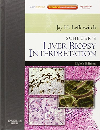 Imagen de archivo de Scheuer's Liver Biopsy Interpretation: Expert Consult: Online and Print a la venta por HPB-Red
