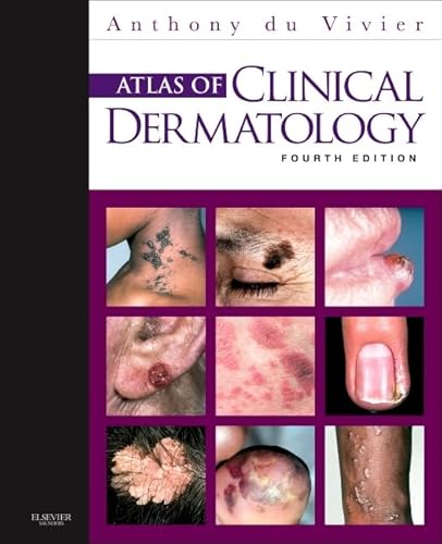 Imagen de archivo de Atlas of Clinical Dermatology, 4e a la venta por SecondSale