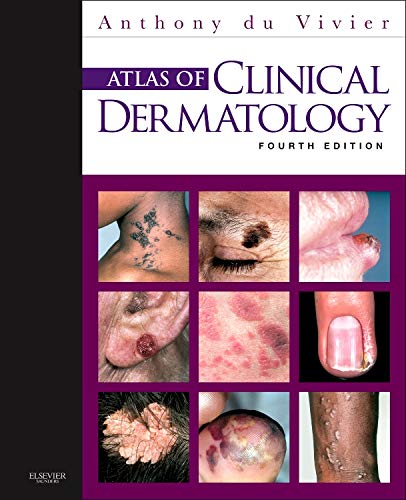 Stock image for Atlas of Clinical Dermatology, 4e for sale by SecondSale