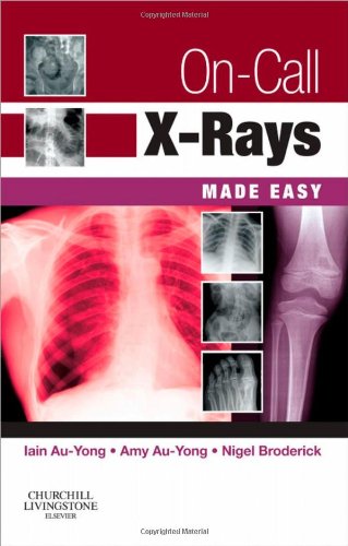 Imagen de archivo de On-Call X-Rays Made Easy, 1e a la venta por Goldstone Books