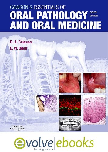 9780702041198: Cawson's Essentials of Oral Pathology and Oral Medicine Text and Evolve eBooks Package, 8e