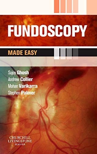 Beispielbild fr Fundoscopy Made Easy zum Verkauf von BooksRun