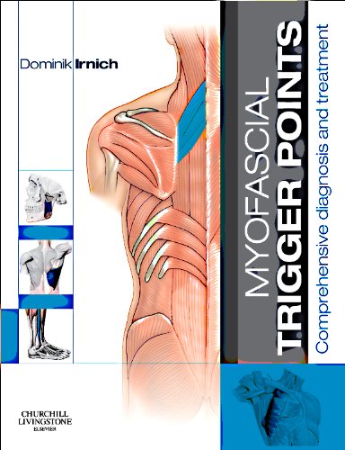 Myofascial Trigger Points: Comprehensive diagnosis and treatment - Irnich MD, Dominik