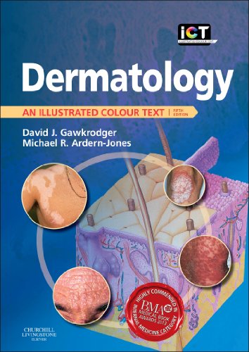 Stock image for Dermatology : An Illustrated Colour Text for sale by Better World Books Ltd