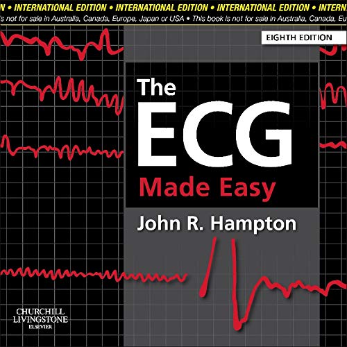 Imagen de archivo de The ECG Made Easy a la venta por AwesomeBooks