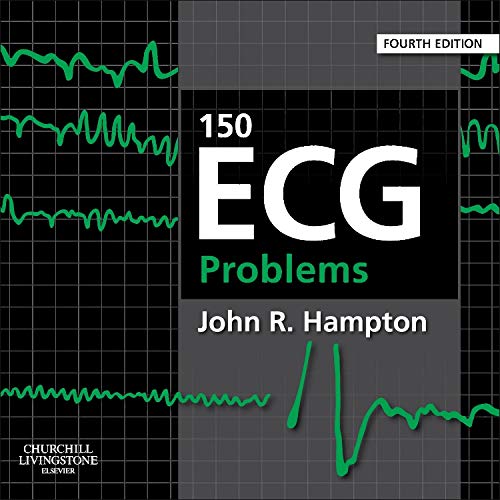 9780702046452: 150 ECG Problems