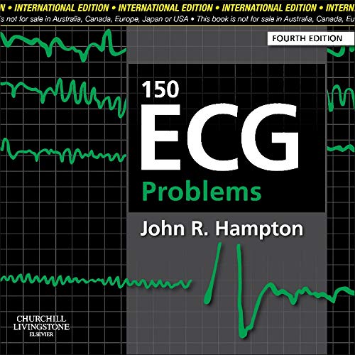 9780702046711: 150 ECG Problems, International Edition