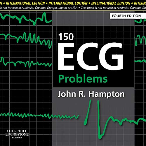 9780702046711: 150 ECG Problems