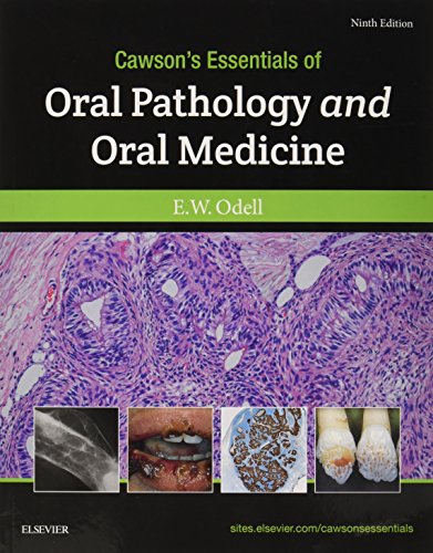 Stock image for Cawson's Essentials of Oral Pathology and Oral Medicine, 9e for sale by PBShop.store US