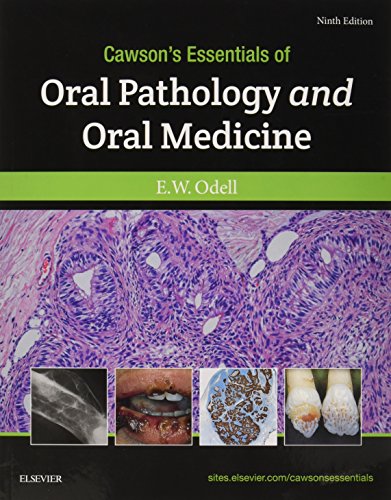 9780702049828: Cawson's Essentials of Oral Pathology and Oral Medicine, 9e