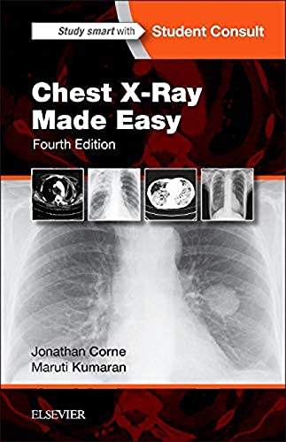 Stock image for Chest X-Ray Made Easy for sale by Better World Books Ltd