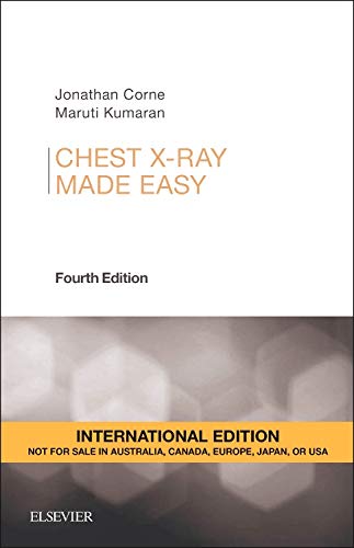 9780702055003: Chest X-Ray Made Easy
