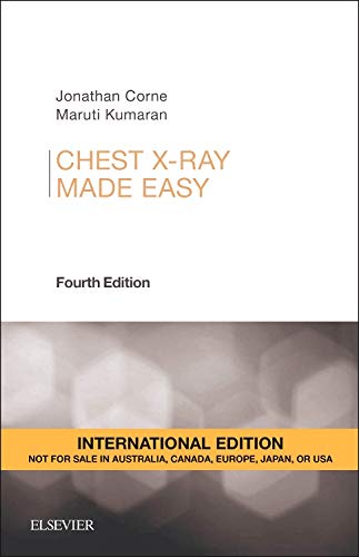 9780702055003: Chest X-Ray Made Easy, International Edition