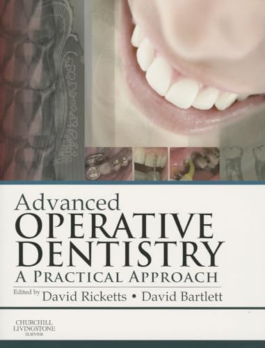 Stock image for Advanced Operative Dentistry: A Practical Approach for sale by Basi6 International