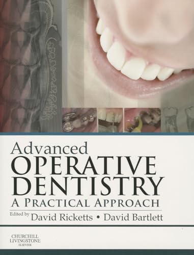 9780702055386: Advanced Operative Dentistry: A Practical Approach