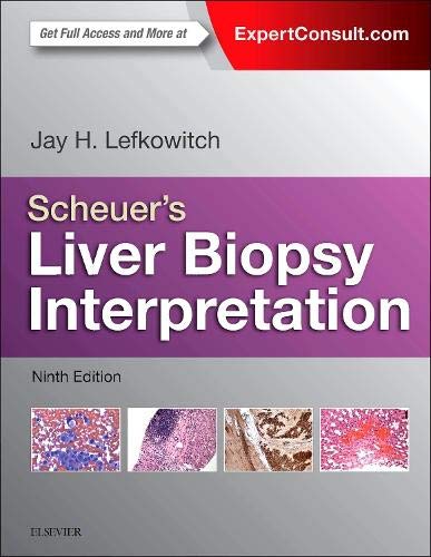 Imagen de archivo de Scheuer's Liver Biopsy Interpretation a la venta por Books Unplugged