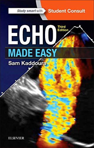 Stock image for Echo Made Easy for sale by WorldofBooks