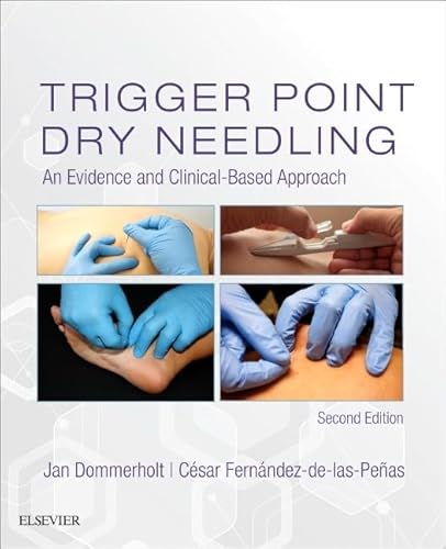 Stock image for Trigger Point Dry Needling : An Evidence and Clinical-Based Approach. for sale by Lost and Found Books