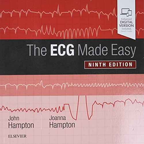 Stock image for The ECG Made Easy for sale by ThriftBooks-Atlanta