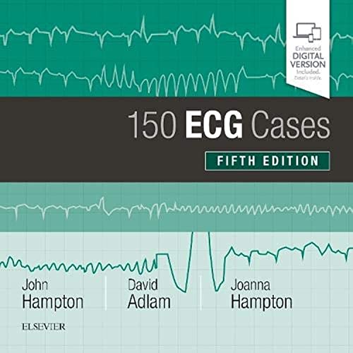 Stock image for 150 ECG Cases for sale by ThriftBooks-Atlanta