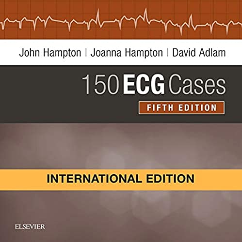 Stock image for 150 Ecg Cases 5Ed (Ie) (Pb 2019) for sale by Kanic Books