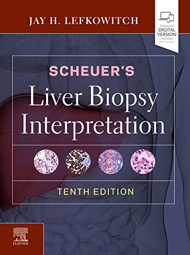 Imagen de archivo de Scheuer's Liver Biopsy Interpretation a la venta por SecondSale