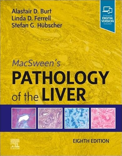 Stock image for MacSweens Pathology of the Liver for sale by Omega