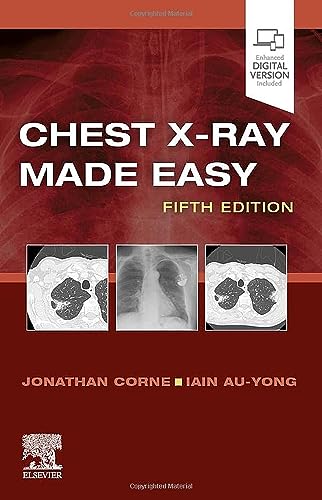 9780702082344: Chest X-Ray Made Easy