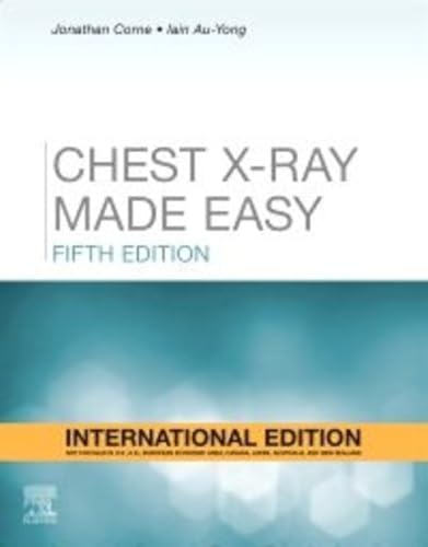 Stock image for Chest X Ray Made Easy 5Ed (Ie) (Pb 2023) for sale by Kanic Books