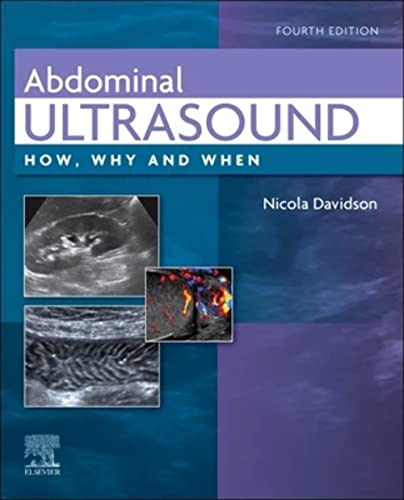 Beispielbild fr Abdominal Ultrasound zum Verkauf von Blackwell's