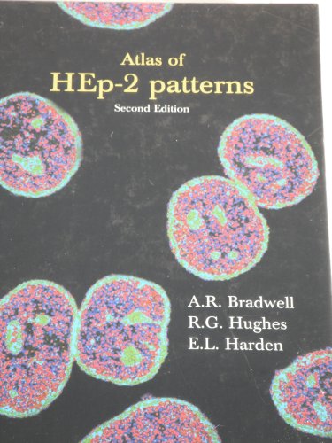 9780704424371: Atlas of Hep-2 Patterns: & Laboratory Techniques