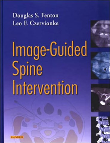 9780721600215: Image-Guided Spine Intervention, 1e
