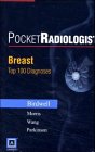 9780721600796: PocketRadiologist - Breast: Top 100 Diagnoses, CD-ROM PDA Software - Palm OS Version (PocketRadiologist S.)