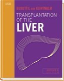 Transplantation of the Liver - Busuttil, Ronald W., Klintmalm, Goran