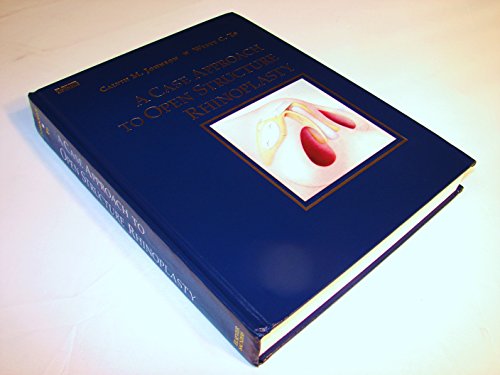 Imagen de archivo de A Case Approach to Open Structure Rhinoplasty a la venta por Book Deals