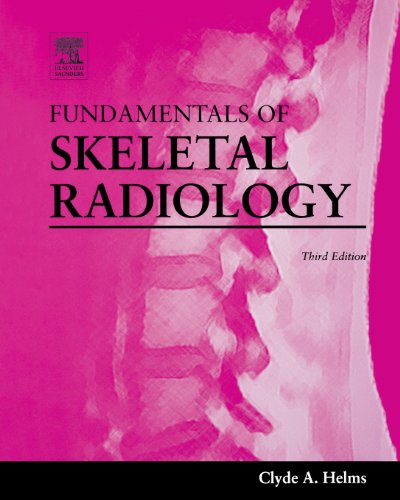 Fundamentals of Skeletal Radiology - Helms, C.A