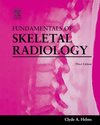 9780721605708: Fundamentals Of Skeletal Radiology