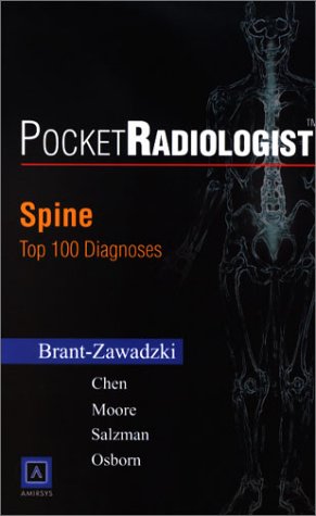 9780721606750: Spine. Top 100 Diagnoses (PocketRadiologist S.)