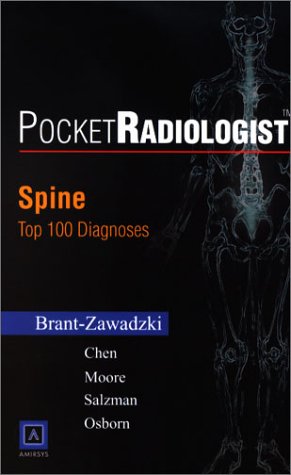 9780721606750: PocketRadiologist - Spine: Top 100 Diagnoses