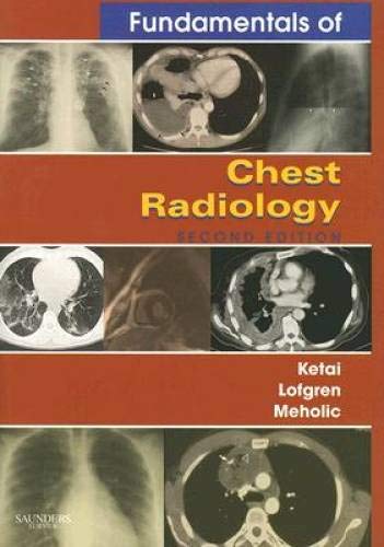 Imagen de archivo de Fundamentals of Chest Radiology (Fundamentals of Radiology) a la venta por SecondSale